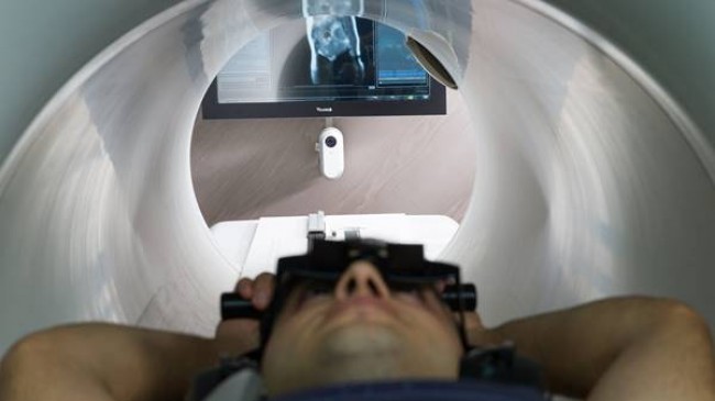 Radyoterapi akıllı ışınlar kanserde tedavi yelpazesini genişletiyor..